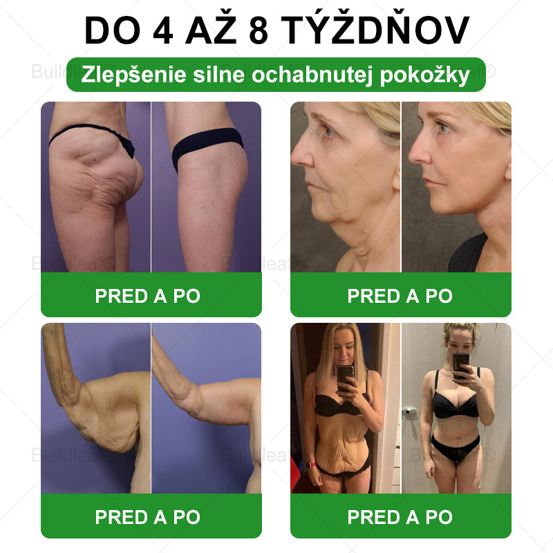 🍀BuildLeaf® GLP-1 6-v-1 Fit & Vital Perorálny Roztok  (Len raz denne, viditeľné zmeny už za 7 dní) Pre obezitu, kardiovaskulárne ochorenia, cukrovku, spánkové apnoe, zdravie čriev, problémy s kĺbmi a ďalšie🌿🌿