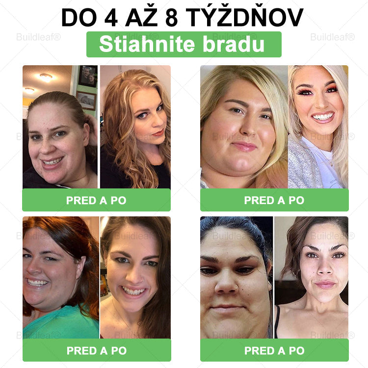 🍀BuildLeaf® GLP-1 6-v-1 Fit & Vital Perorálny Roztok  (Len raz denne, viditeľné zmeny už za 7 dní) Pre obezitu, kardiovaskulárne ochorenia, cukrovku, spánkové apnoe, zdravie čriev, problémy s kĺbmi a ďalšie🌿🌿