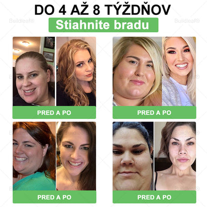 🍀BuildLeaf® GLP-1 6-v-1 Fit & Vital Perorálny Roztok  (Len raz denne, viditeľné zmeny už za 7 dní) Pre obezitu, kardiovaskulárne ochorenia, cukrovku, spánkové apnoe, zdravie čriev, problémy s kĺbmi a ďalšie🌿🌿