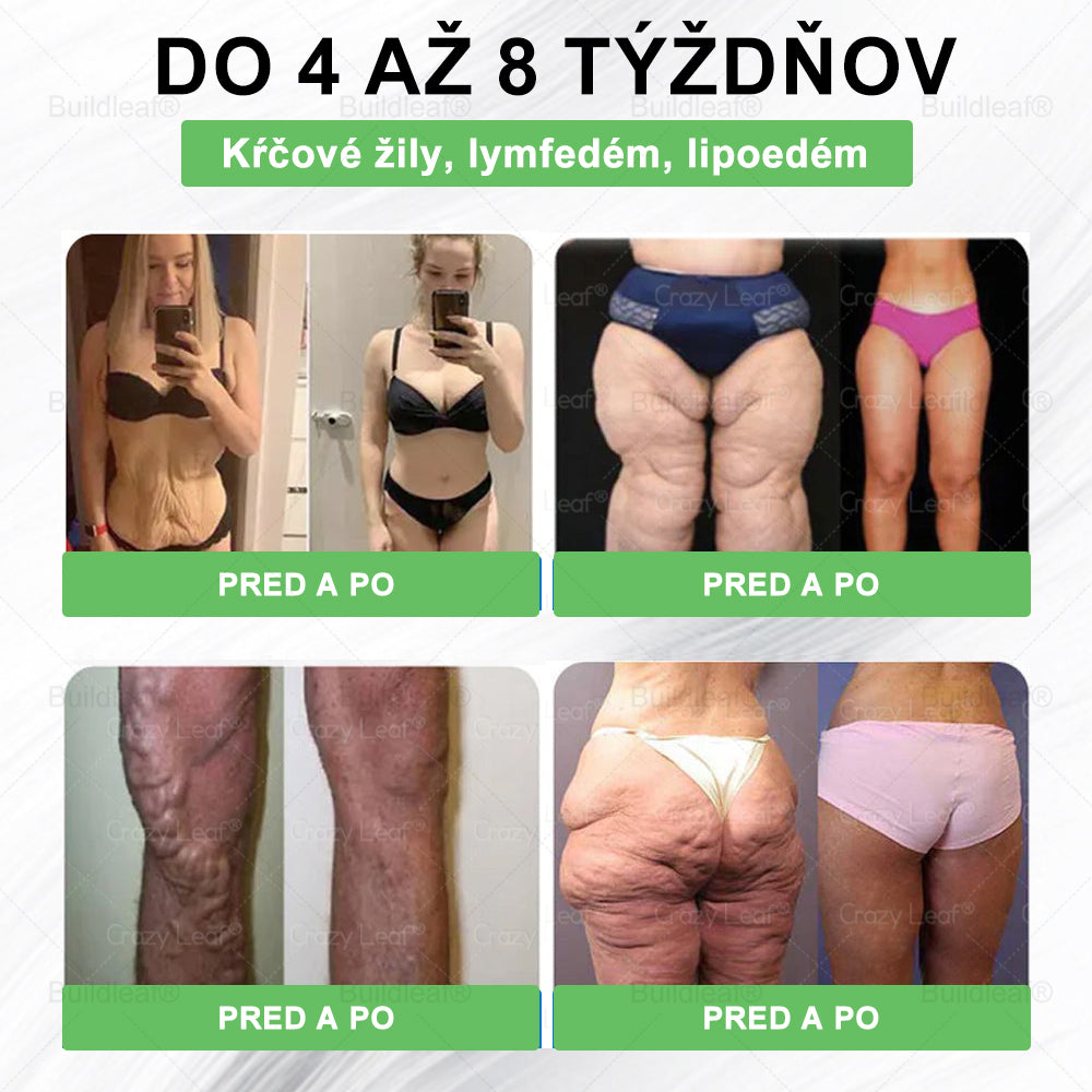 🍀BuildLeaf® GLP-1 6-v-1 Fit & Vital Perorálny Roztok  (Len raz denne, viditeľné zmeny už za 7 dní) Pre obezitu, kardiovaskulárne ochorenia, cukrovku, spánkové apnoe, zdravie čriev, problémy s kĺbmi a ďalšie🌿🌿